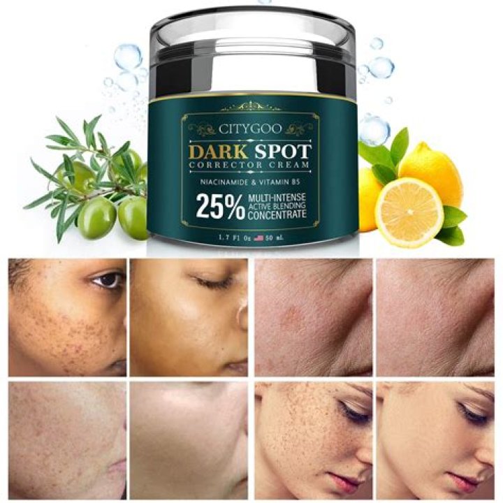A cream for your dark skin