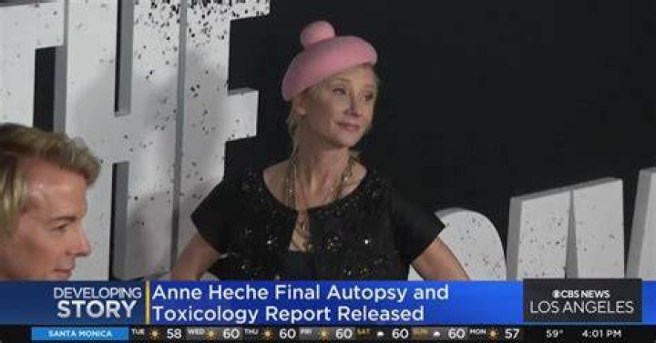 Anne Heche Autopsy