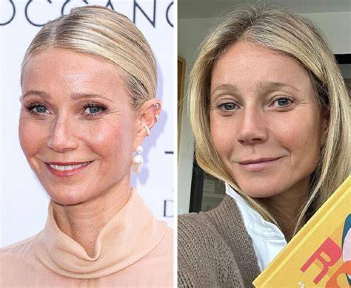 bare-faced celebrities bare-faced celebrities