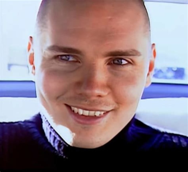 Billy Corgan Teeth