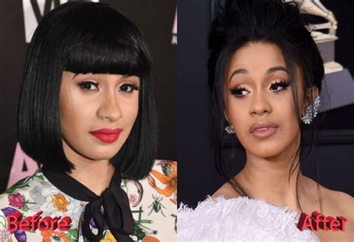 cardi b plastic surgery