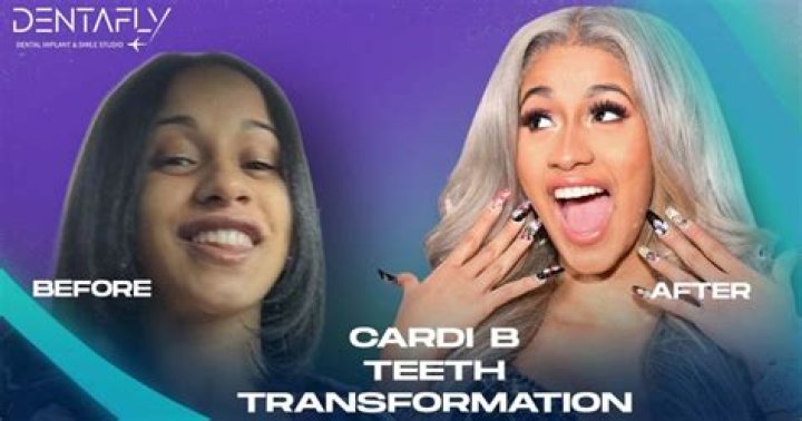 cardi b teeth transformation