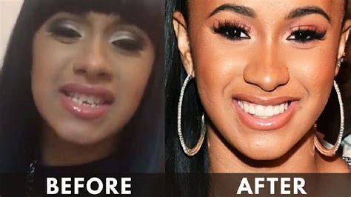 cardi b teeth