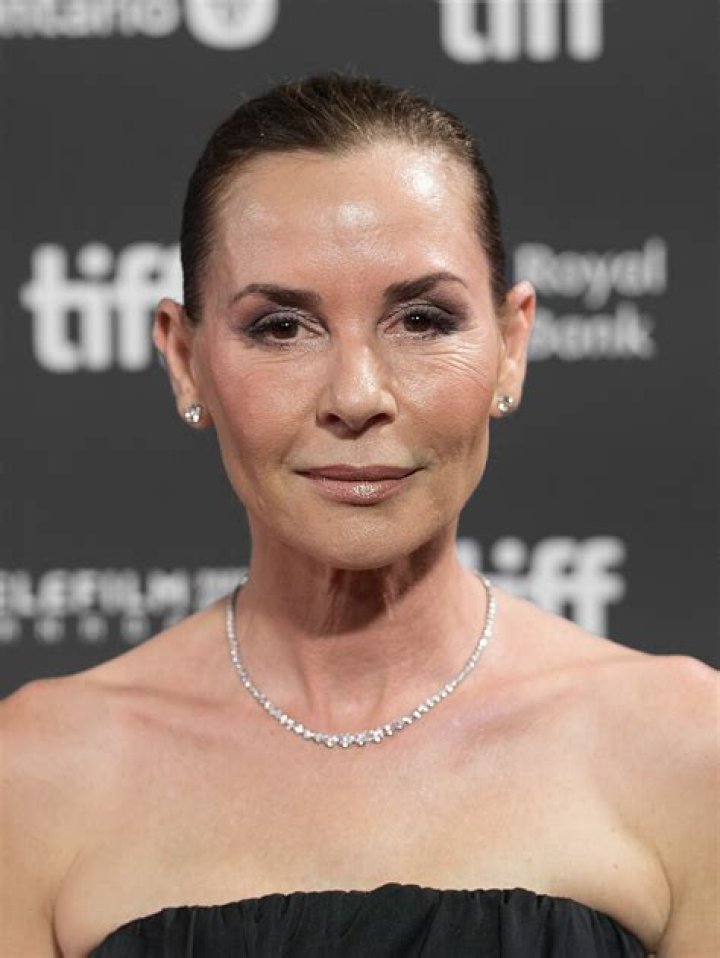 Embeth Davidtz Plastic Surgery