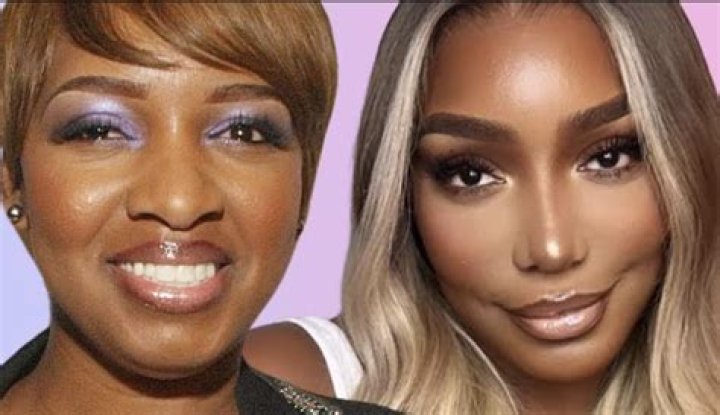 NeNe Leakes plastic surgery