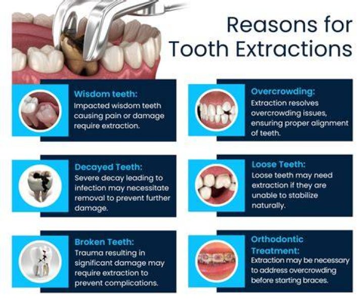 risks of tooth extraction