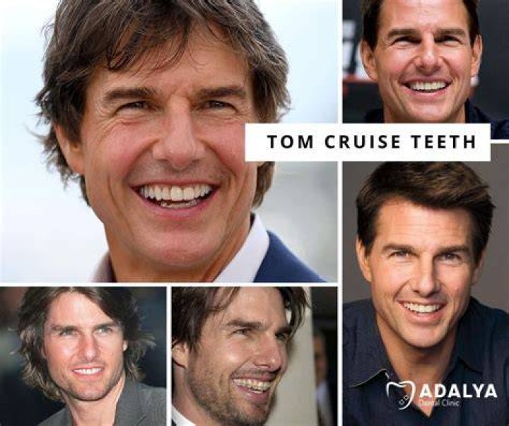 Tom Cruise teeth in The Outsiders