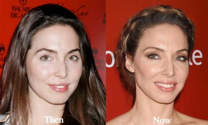 Whitney Cummings plastic surgery